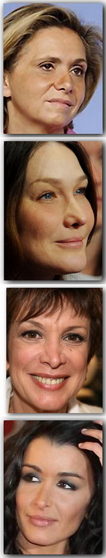  rhinoplasties-valerie pecresse-carla bruni-catherine laborde-jennifer