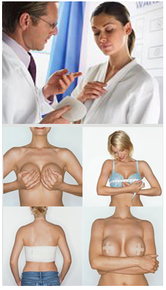 Chirurgie esthétique: quand changer ses prothèses mammaire