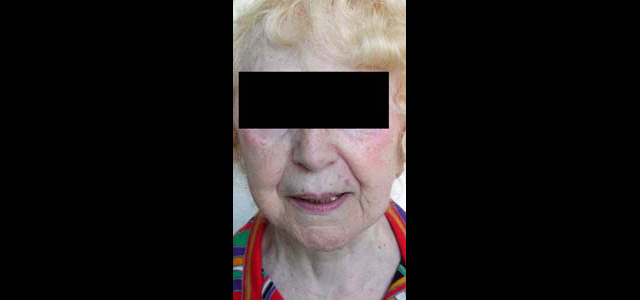 chirurgie-esthetique-interventions-visage-liftings