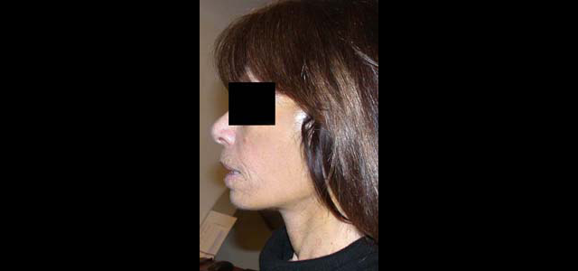 chirurgie-esthetique-interventions-visage-liftings