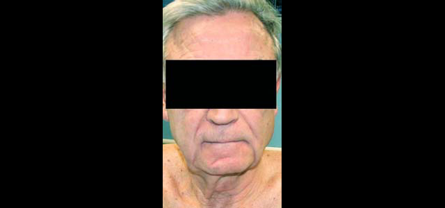 chirurgie-esthetique-interventions-visage-liftings