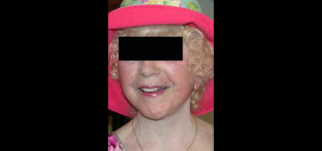 chirurgie-esthetique-interventions-visage-liftings