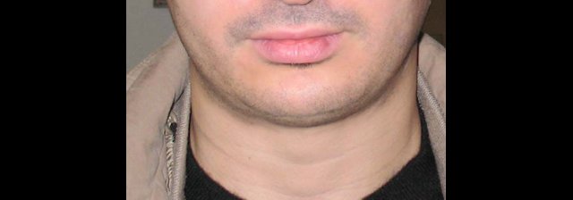 résultat de face