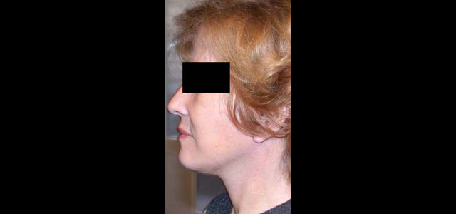 chirurgie-esthetique-interventions-visage-liftings