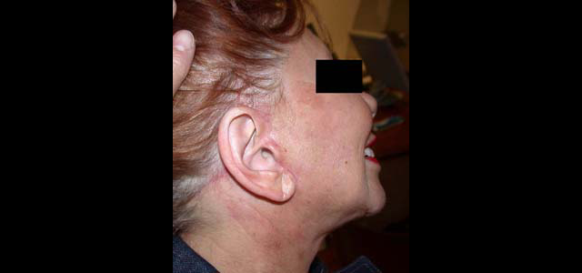 chirurgie-esthetique-interventions-visage-liftings