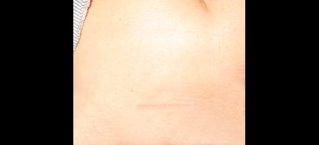 chirurgie-esthetique-tatouages-2