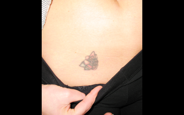 chirurgie-esthetique-tatouages