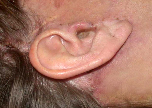 chirurgie-esthetique-interventions-visage-liftings